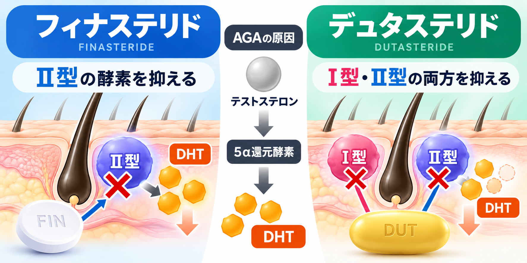 フィナステリドとデュタステリドのAGAに対する作用の違い